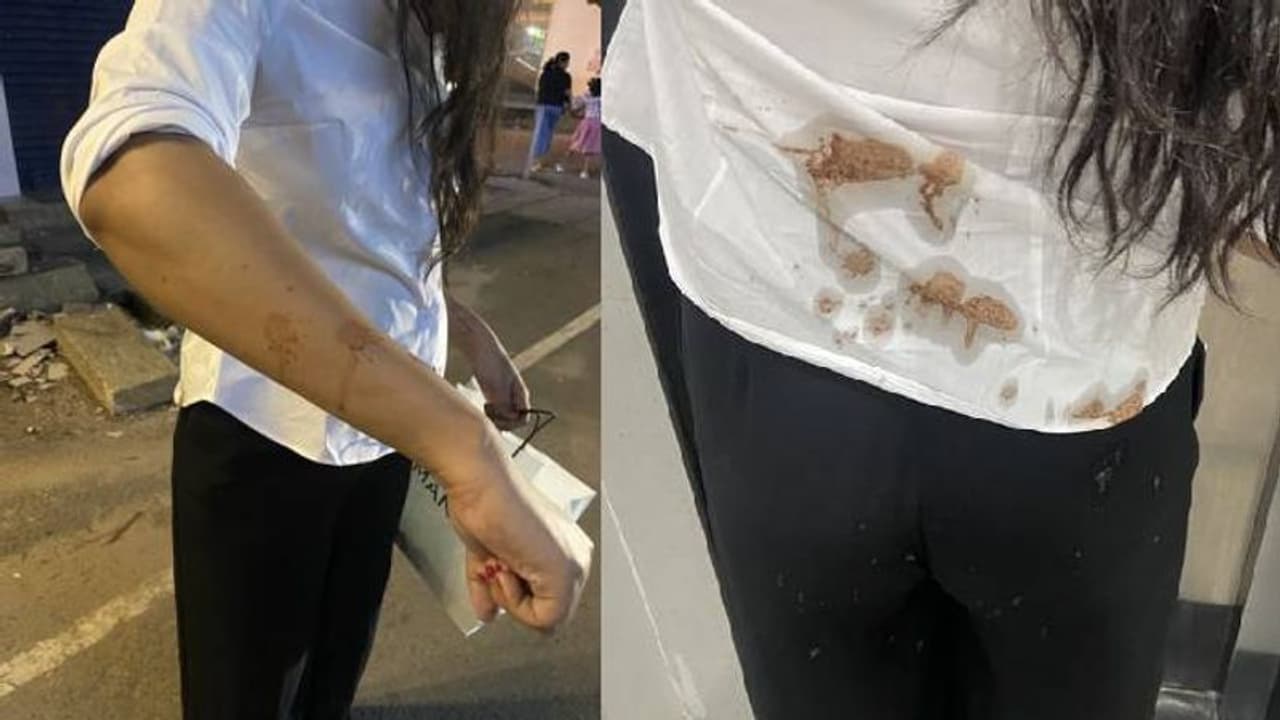 വഴിയേ നടന്ന യുവതിയുടെ മേൽ തുപ്പി ഓട്ടോഡ്രൈവർ, വിവരം തരൂ എന്ന് പൊലീസ് വഴിയേ നടന്ന യുവതിയുടെ മേൽ തുപ്പി ഓട്ടോഡ്രൈവർ, വിവരം തരൂ എന്ന് പൊലീസ്