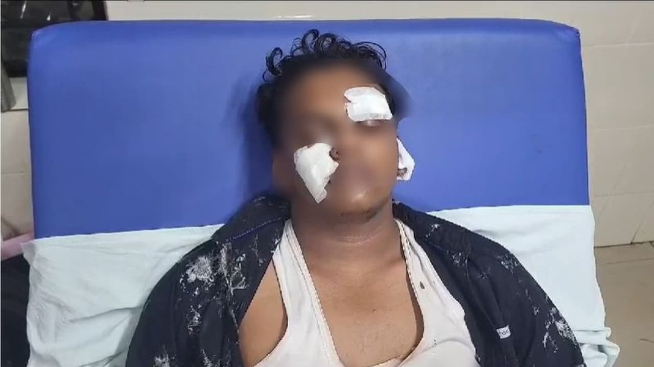 വയനാട്ടിൽ പത്താം ക്ലാസ് വിദ്യാര്‍ത്ഥിക്ക് ക്രൂര മര്‍ദ്ദനം: കത്രിക കൊണ്ട് സഹപാഠികൾ കുത്തി