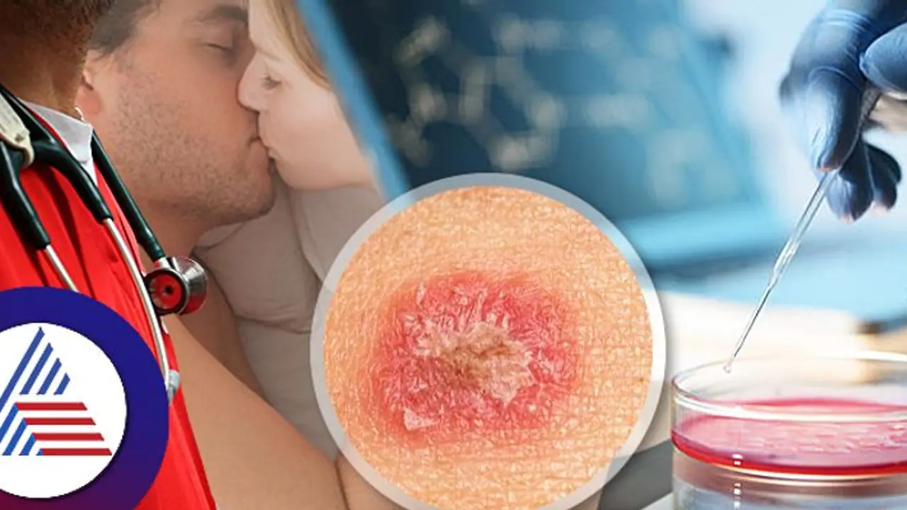 ಅಪರಿಚತರೊಂದಿಗೆ ಲೈಂಗಿಕ ಸಂಪರ್ಕ: ಹರಡುತ್ತೆ ಫಂಗಲ್ ಸೋಂಕು, ಎಚ್ಚರ ಬೇಡದ ಕೆಲ್ಸಕ್ಕೆ ಕೈ ಹಾಕೋ ಮುನ್ನ