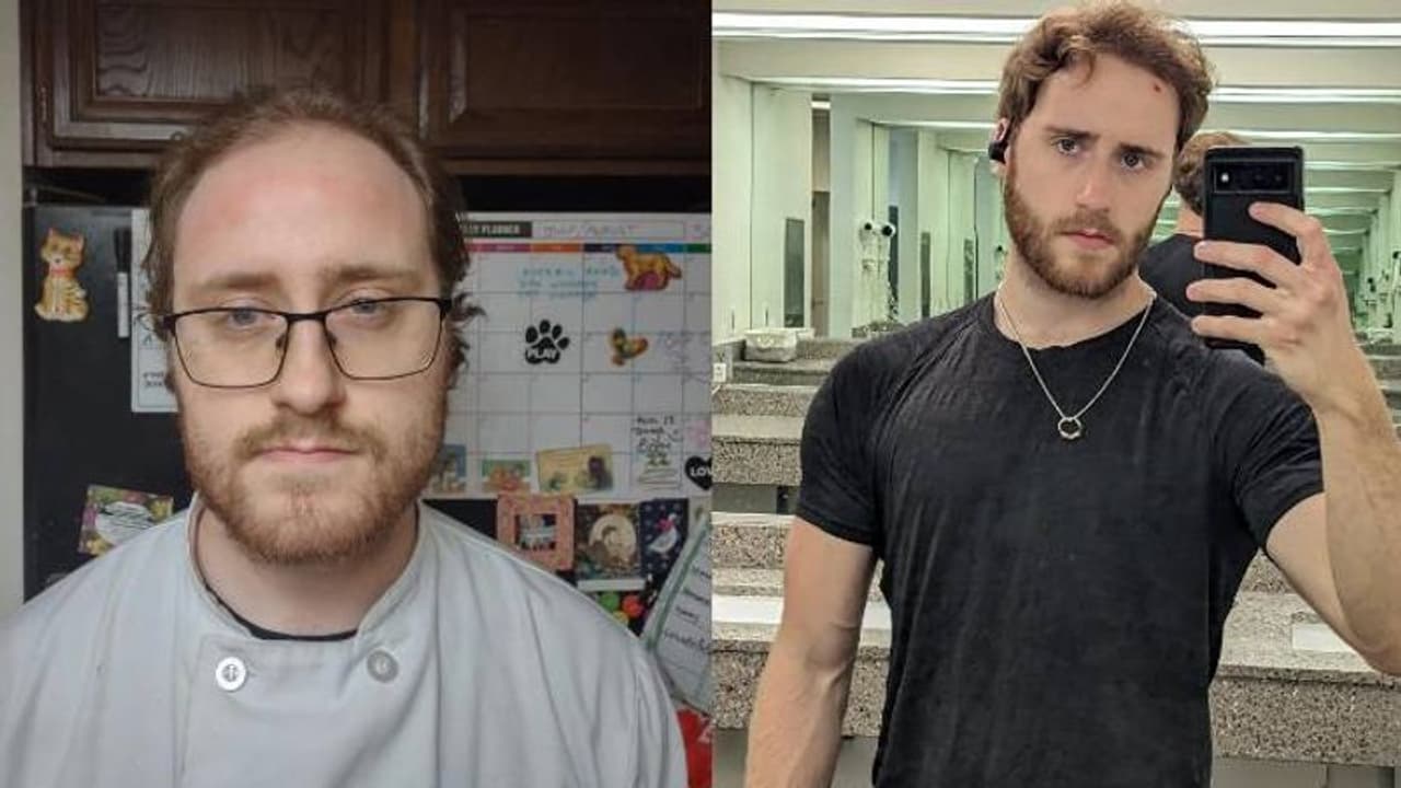 Toxic Relationship : ಬ್ರೇಕ್‌ ಅಪ್‌ ನಂತ್ರ ಇಷ್ಟೊಂದು ಬದಲಾವಣೆ…! ಫೋಟೋ ನೋಡಿ ನೆಟ್ಟಿಗರು ದಂಗು 