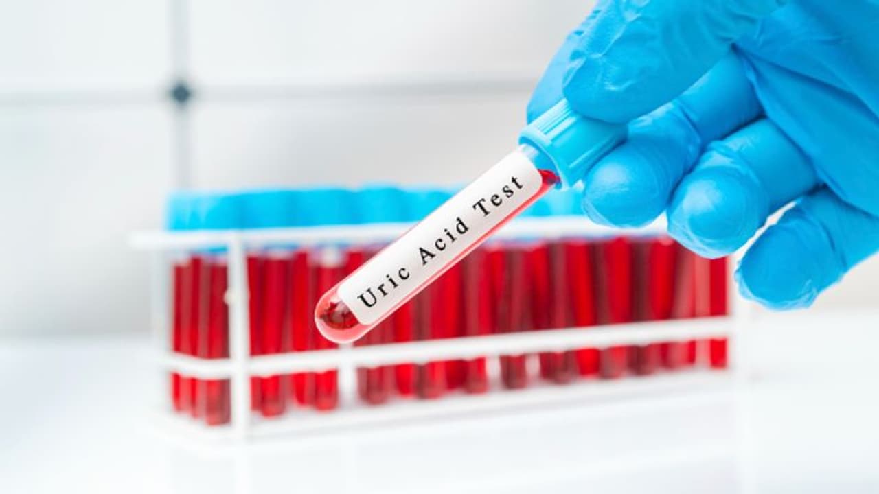 ഗൗട്ടിനെ തടയാനും യൂറിക് ആസിഡ് തോത് കുറയ്ക്കാനും ശ്രദ്ധിക്കേണ്ട കാര്യങ്ങള്‍