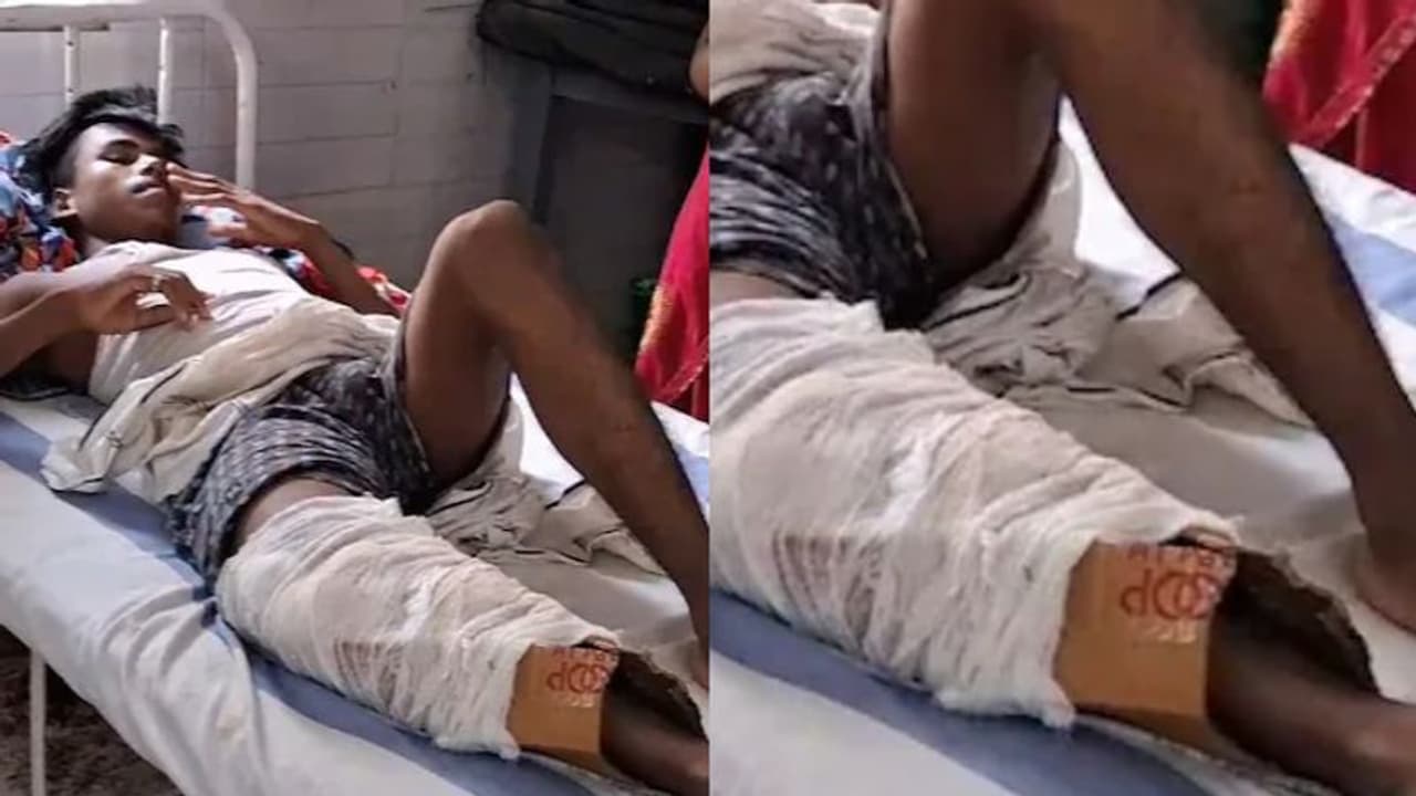 ബൈക്കിൽ നിന്ന് വീണ് കാലൊടിഞ്ഞ യുവാവിന് 'പ്ലാസ്റ്ററിട്ട്' കൊടുത്തത് കാർഡ് ബോർഡ് കൊണ്ട്, ഗുരുതര വീഴ്ച ബിഹാറിൽ ബൈക്കിൽ നിന്ന് വീണ് കാലൊടിഞ്ഞ യുവാവിന് 'പ്ലാസ്റ്ററിട്ട്' കൊടുത്തത് കാർഡ് ബോർഡ് കൊണ്ട്, ഗുരുതര വീഴ്ച ബിഹാറിൽ