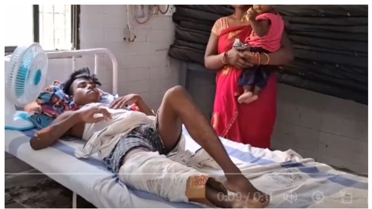 ഒടിഞ്ഞ കാല് പ്ലാസ്റ്റര് ഇടാന് കാർഡ്ബോർഡ്; ബീഹാർ മോഡൽ 'ആരോഗ്യ സുരക്ഷ', വിവാദം ഒടിഞ്ഞ കാല് പ്ലാസ്റ്റര് ഇടാന് കാർഡ്ബോർഡ്; ബീഹാർ മോഡൽ 'ആരോഗ്യ സുരക്ഷ', വിവാദം