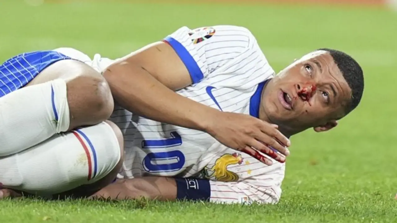 Euro 2024: France may be without Kylian Mbappe until quarter finals after broken nose drama: Report Euro 2024: France may be without Kylian Mbappe until quarter finals after broken nose drama: Report
