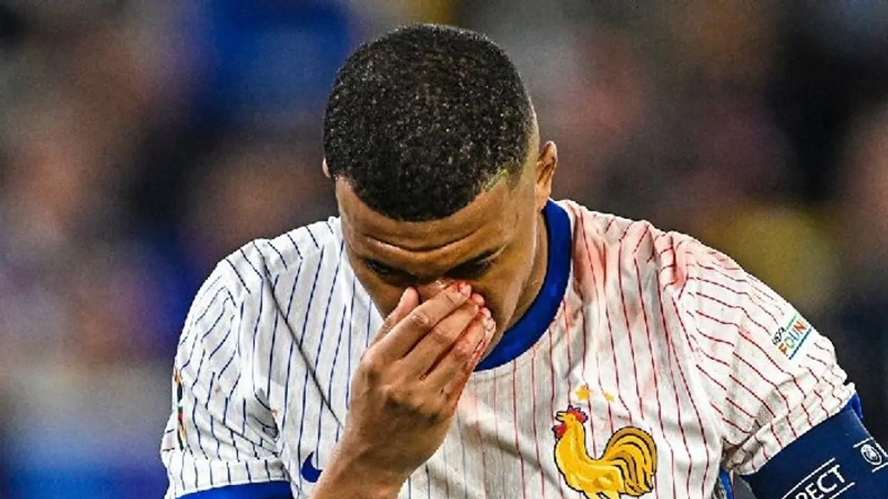 Euro 2024: France's Deschamps dubs Kylian Mbappe's broken nose situation as 'complicated, unfortunate' (WATCH) Euro 2024: France's Deschamps dubs Kylian Mbappe's broken nose situation as 'complicated, unfortunate' (WATCH)