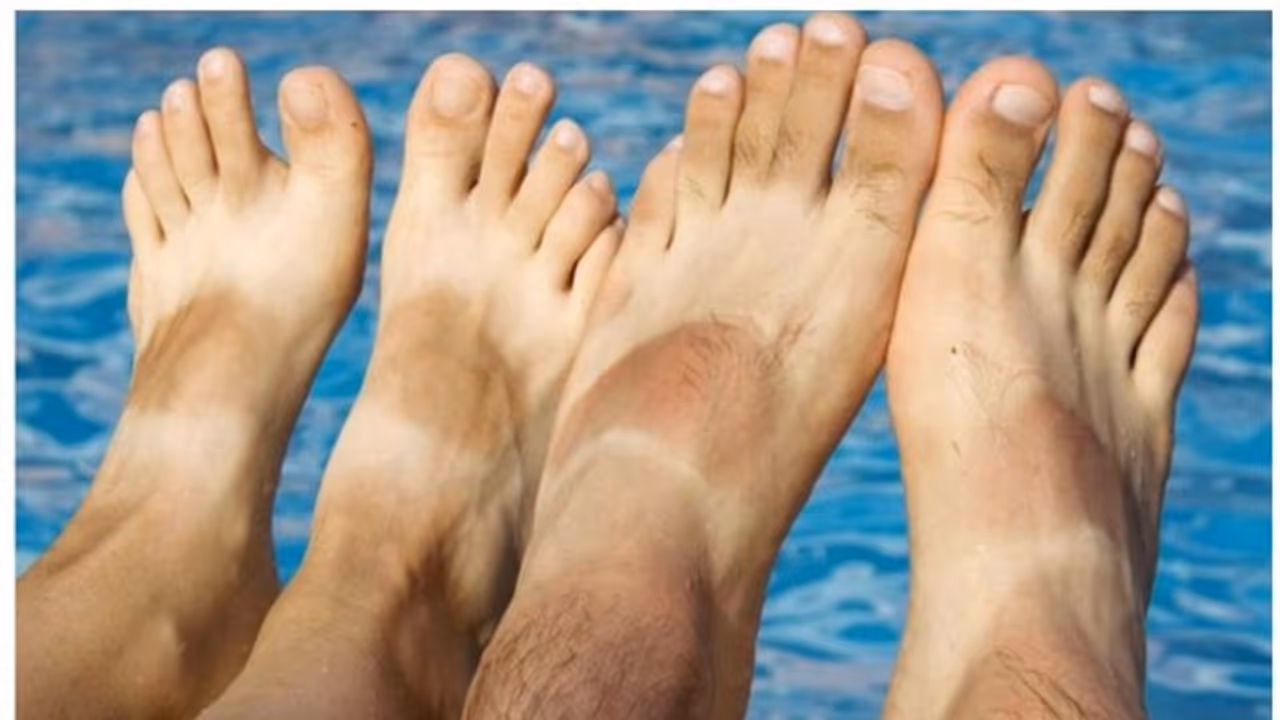 പാദങ്ങളിലെ സൺ ടാൻ എളുപ്പം അകറ്റാം ; പരീക്ഷിക്കാം ഈ പൊടിക്കെെകൾ പാദങ്ങളിലെ സൺ ടാൻ എളുപ്പം അകറ്റാം ; പരീക്ഷിക്കാം ഈ പൊടിക്കെെകൾ