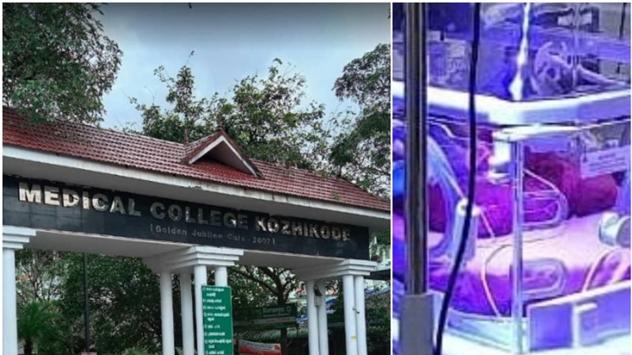 28 ആഴ്ചയായപ്പോൾ സിസേറിയൻ, ജനിച്ചത് ഇരട്ടകൾ; ഒരു കുഞ്ഞിന് ഭാരം 695 ഗ്രാം, ജീവൻ രക്ഷിച്ച് കോഴിക്കോട് മെഡി. കോളജ് 28 ആഴ്ചയായപ്പോൾ സിസേറിയൻ, ജനിച്ചത് ഇരട്ടകൾ; ഒരു കുഞ്ഞിന് ഭാരം 695 ഗ്രാം, ജീവൻ രക്ഷിച്ച് കോഴിക്കോട് മെഡി. കോളജ്