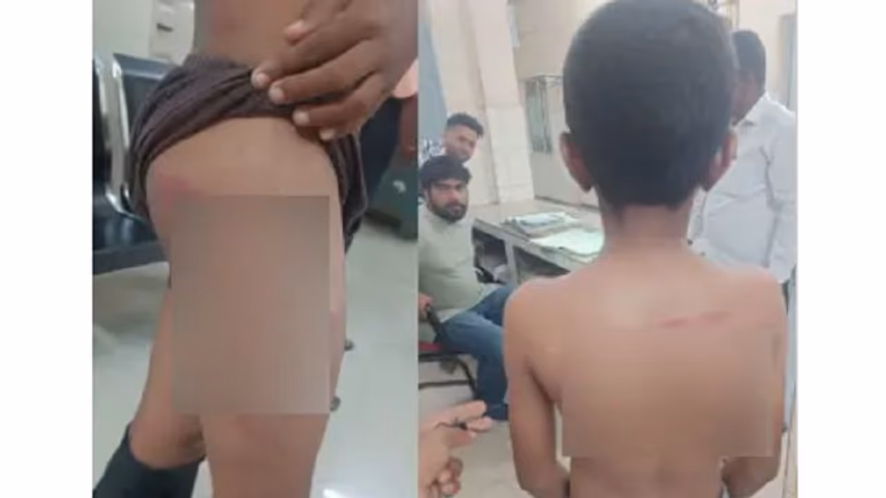 Bidar: ಹೋಮ್ವರ್ಕ್ ಮಾಡದ್ದಕ್ಕೆ ವಿದ್ಯಾರ್ಥಿಗೆ ರಕ್ತ, ಬಾಸುಂಡೆ ಬರುವಂತೆ ಥಳಿಸಿದ ಶಿಕ್ಷಕ! Bidar: ಹೋಮ್ವರ್ಕ್ ಮಾಡದ್ದಕ್ಕೆ ವಿದ್ಯಾರ್ಥಿಗೆ ರಕ್ತ, ಬಾಸುಂಡೆ ಬರುವಂತೆ ಥಳಿಸಿದ ಶಿಕ್ಷಕ!