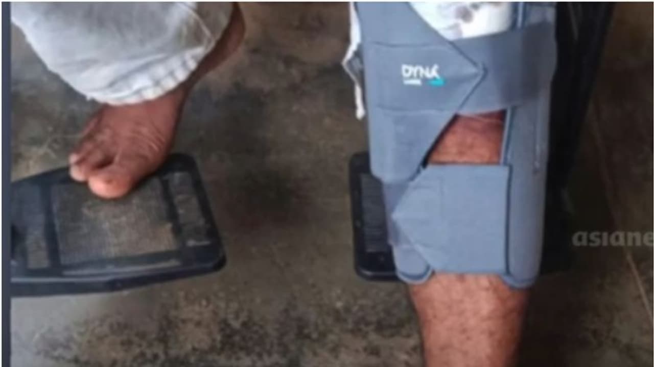 കാട്ടുപന്നി കുറുകെ ചാടി ബൈക്ക് യാത്രികന് പരിക്ക്; പ്രദേശത്ത് പന്നി ശല്യം രൂക്ഷം, നടപടി വേണമെന്ന് നാട്ടുകാര് കാട്ടുപന്നി കുറുകെ ചാടി ബൈക്ക് യാത്രികന് പരിക്ക്; പ്രദേശത്ത് പന്നി ശല്യം രൂക്ഷം, നടപടി വേണമെന്ന് നാട്ടുകാര്