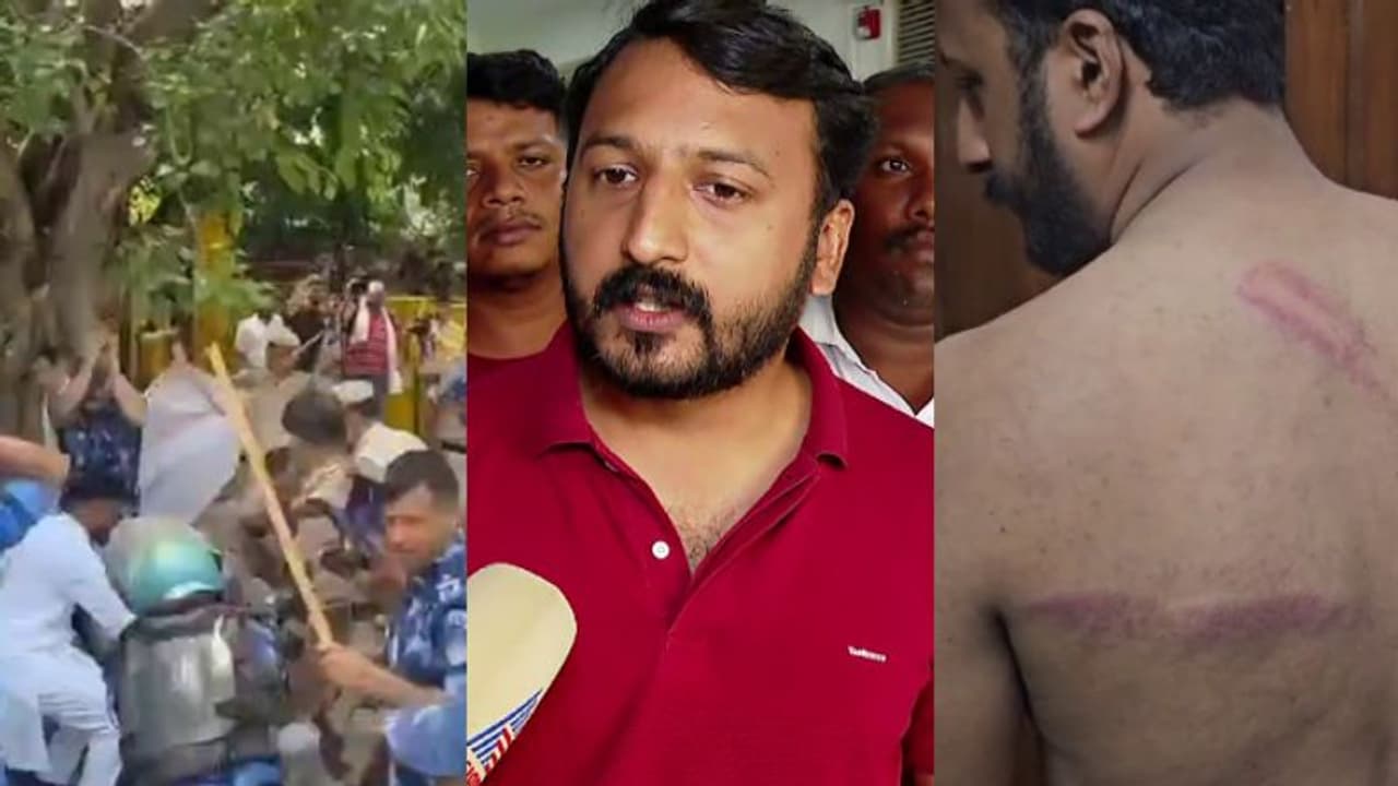 നീറ്റ് ചോദ്യപേപ്പർ ചോർച്ച; ദില്ലിയിലെ യൂത്ത് കോൺഗ്രസ് മാർച്ചിൽ സംഘർഷം, രാഹുല് മാങ്കൂട്ടത്തിലിനടക്കം പരിക്ക് നീറ്റ് ചോദ്യപേപ്പർ ചോർച്ച; ദില്ലിയിലെ യൂത്ത് കോൺഗ്രസ് മാർച്ചിൽ സംഘർഷം, രാഹുല് മാങ്കൂട്ടത്തിലിനടക്കം പരിക്ക്