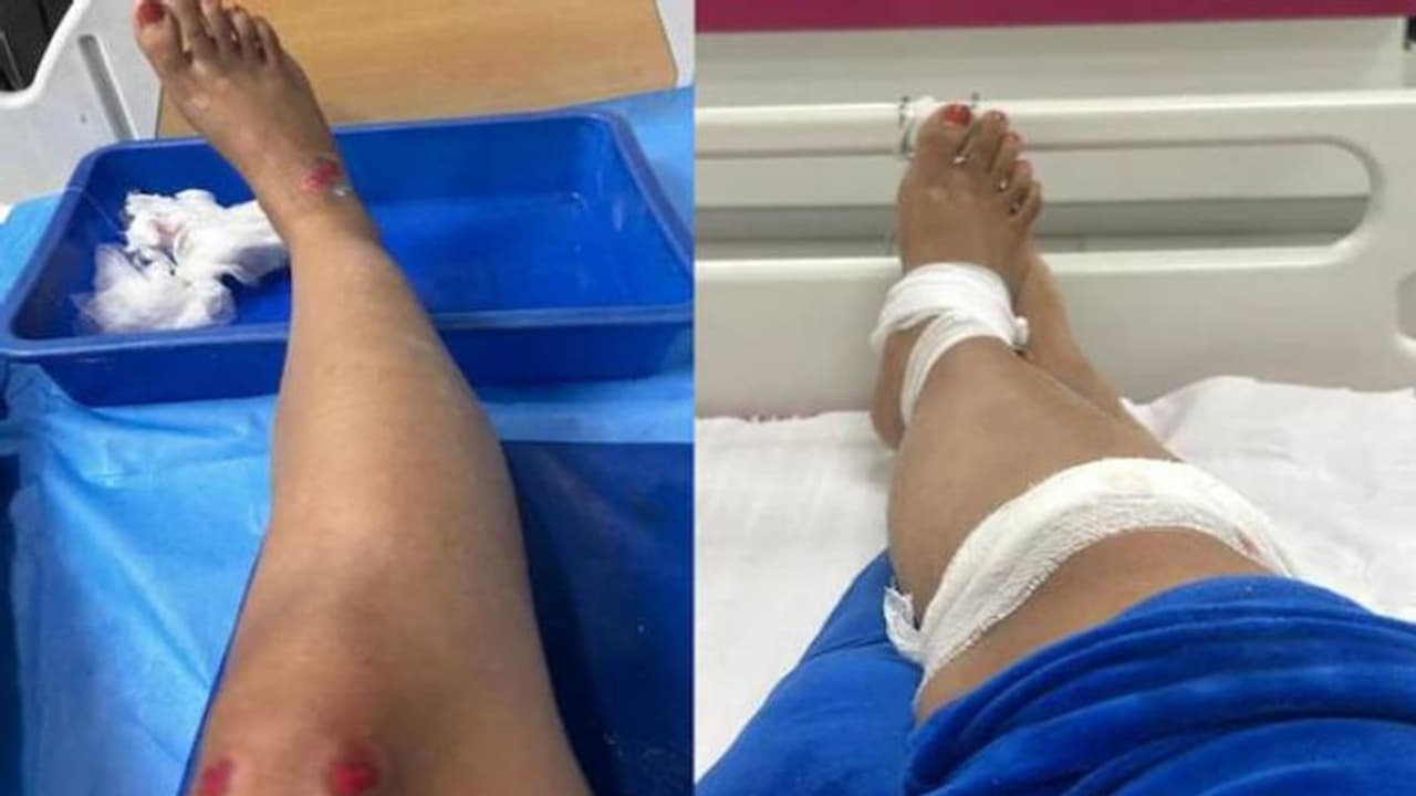 'ജീവിതത്തിൽ ഒരിക്കലുമിനി റാപ്പിഡോ എടുക്കില്ല': യാത്രയിലുണ്ടായ ദുരനുഭവം വെളിപ്പെടുത്തി യുവതി