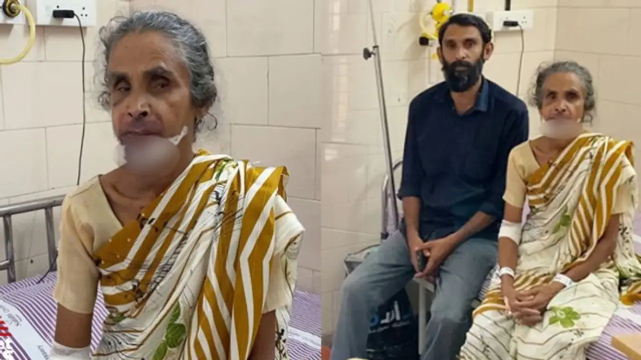 കോഴിക്കോട് ഓട്ടോയിൽ കയറിയ വയോധികയുടെ മാല കവര്‍ന്ന് റോഡിലേക്ക് തള്ളിയിട്ട് ഡ്രൈവര്‍, താടിയെല്ലിന് പരിക്ക്