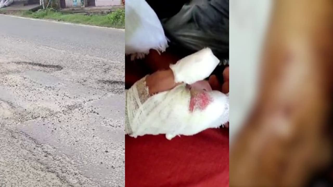 റോഡിലെ ഗട്ടറിൽ ഇറങ്ങി കെഎസ്ആർടിസി ബസിൻെറ ഡോർ തനിയെ തുറന്നു, റോഡിലേക്ക് തെറിച്ചുവീണ വിദ്യാർത്ഥിക്ക് പരിക്ക് റോഡിലെ ഗട്ടറിൽ ഇറങ്ങി കെഎസ്ആർടിസി ബസിൻെറ ഡോർ തനിയെ തുറന്നു, റോഡിലേക്ക് തെറിച്ചുവീണ വിദ്യാർത്ഥിക്ക് പരിക്ക്