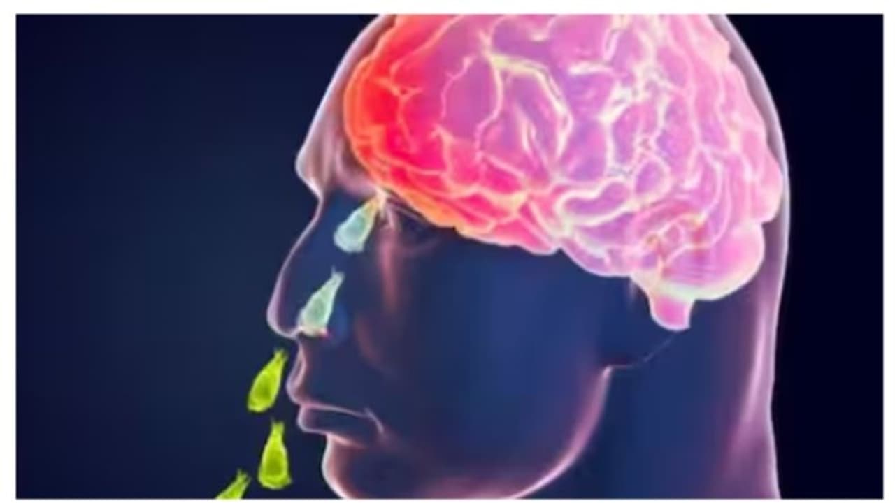 കണ്ണൂരിൽ മൂന്നരവയസുകാരന് അമീബിക് മസ്തിഷ്ക ജ്വരം സ്ഥിരീകരിച്ചു