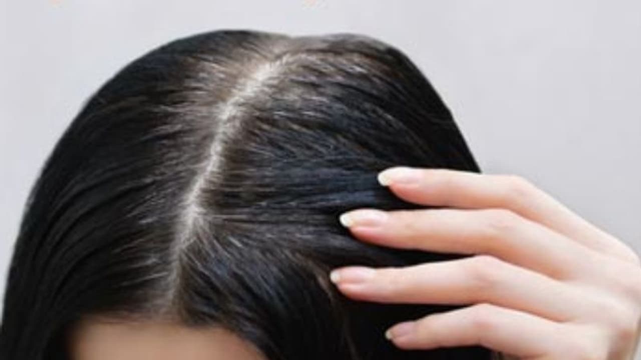 അകാലനര അകറ്റാന് വീട്ടില് പരീക്ഷിക്കാം ഈ വഴികള് അകാലനര അകറ്റാന് വീട്ടില് പരീക്ഷിക്കാം ഈ വഴികള്