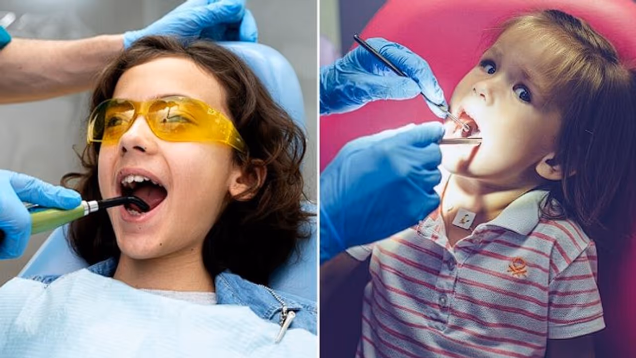 Abscessed tooth in children: Lifestyle factors, causes, symptoms, treatment, and prevention Abscessed tooth in children: Lifestyle factors, causes, symptoms, treatment, and prevention