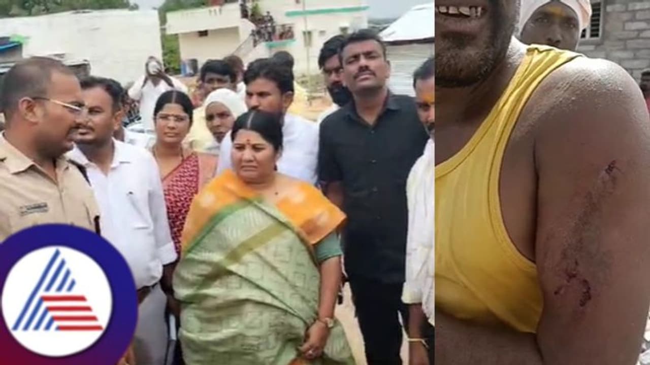 ದೇವದುರ್ಗ: ಹೆದರಿಸಲು ಹೋದ ಮೂವರ ಮೇಲೆ ಚಿರತೆ ದಾಳಿ! ದೇವದುರ್ಗ: ಹೆದರಿಸಲು ಹೋದ ಮೂವರ ಮೇಲೆ ಚಿರತೆ ದಾಳಿ!