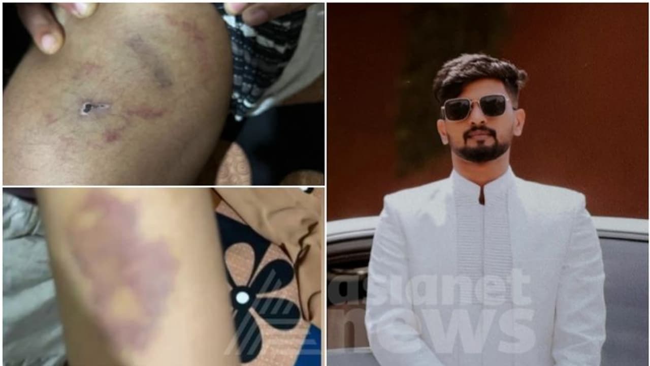 ചേർത്തത് നിസാര വകുപ്പുകൾ, പ്രതിയെ പിടികൂടിയില്ല; നവവധുവിന് പീഡനമേറ്റ സംഭവത്തിൽ പൊലീസിന് ഗുരുതര വീഴ്ച