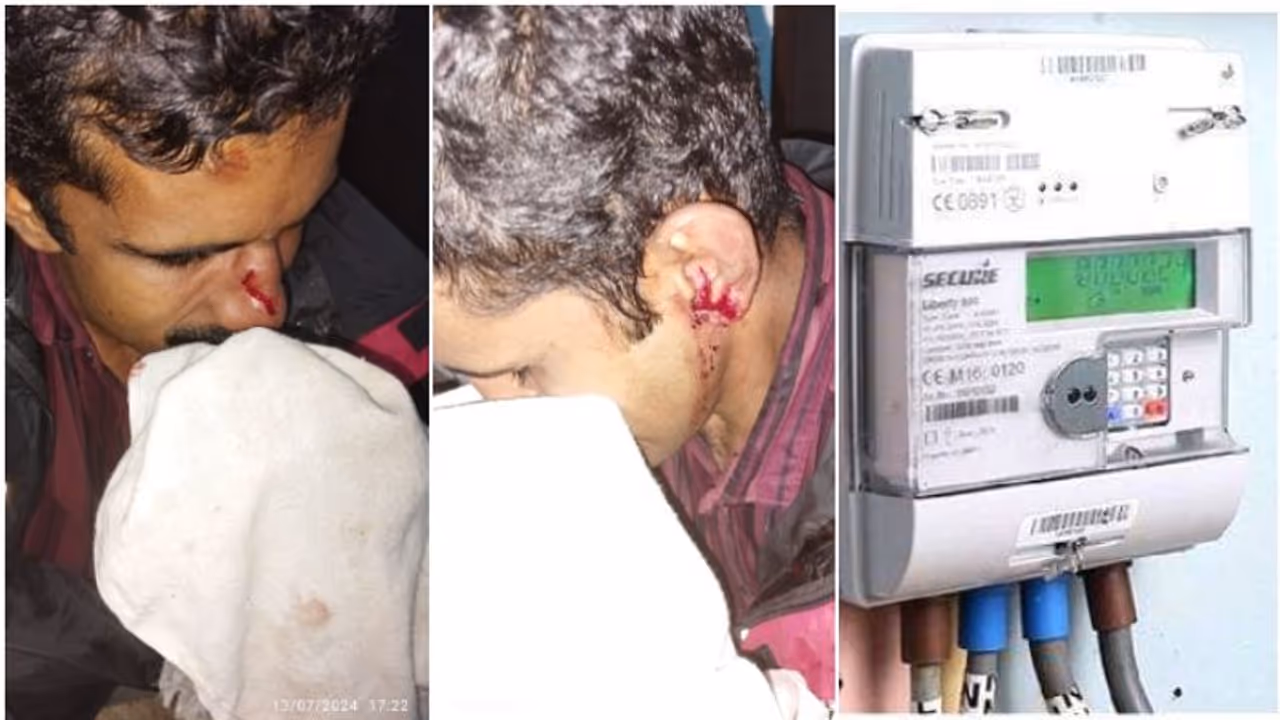 കേടായ മീറ്റർ മാറ്റിവെച്ചതിൽ വൈരാഗ്യം, കെഎസ്ഇബി ജീവനക്കാരെ ജീപ്പിടിപ്പിച്ച് വീട്ടുടമ, ജാക്കി ലിവർ കൊണ്ടടിച്ചു 