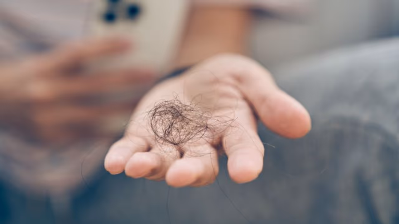 തലമുടി കൊഴിച്ചില് തടയാന് ശ്രദ്ധിക്കേണ്ട ഏഴ് കാര്യങ്ങള് തലമുടി കൊഴിച്ചില് തടയാന് ശ്രദ്ധിക്കേണ്ട ഏഴ് കാര്യങ്ങള്