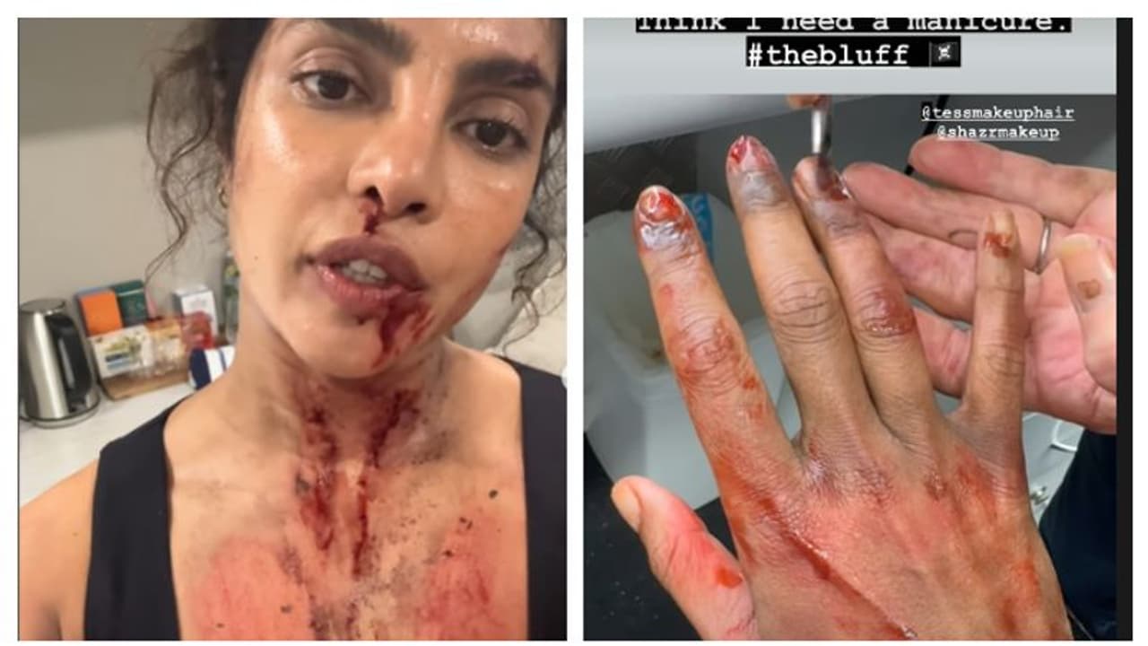 Did Priyanka Chopra INJURE her hand during the filming of her movie 'The Bluff'? Here's what we know