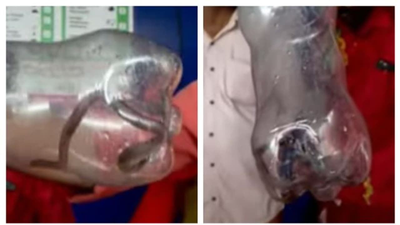 മകളുമായി സർക്കാർ ആശുപത്രിയിലെത്തിയ അമ്മയ്ക്ക് പാമ്പുകടിയേറ്റു മകളുമായി സർക്കാർ ആശുപത്രിയിലെത്തിയ അമ്മയ്ക്ക് പാമ്പുകടിയേറ്റു