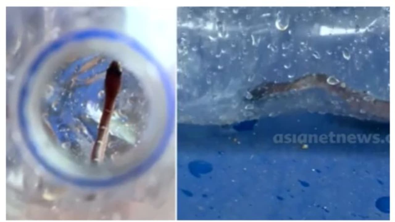 താലൂക്ക് ആശുപത്രിയിൽ യുവതിക്ക് പാമ്പുകടിയേറ്റ സംഭവം; സൂപ്രണ്ടിനോട് റിപ്പോർട്ട് തേടി ഡിഎംഒ