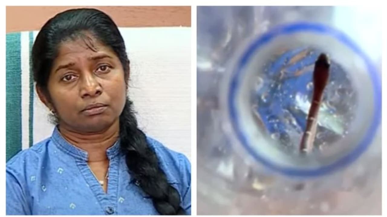 'പാമ്പുകടിയേറ്റിട്ടില്ല, സംശയത്തിന്‍റെ പേരില്‍ റഫര്‍ ചെയ്തത് ശരിയായില്ല': നിഷേധിച്ച് ആരോ​ഗ്യവകുപ്പ് ഡയറക്ടർ