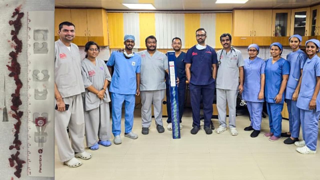 ശ്വാസകോശ ധമനികളിൽ രക്തം അടിയും, മരണംവരെ സംഭവിക്കാവുന്ന അവസ്ഥ, പൾമനറി എംബോളിസത്തിന് എഐ സഹായത്തിൽ ചികിത്സ വിജയം ശ്വാസകോശ ധമനികളിൽ രക്തം അടിയും, മരണംവരെ സംഭവിക്കാവുന്ന അവസ്ഥ, പൾമനറി എംബോളിസത്തിന് എഐ സഹായത്തിൽ ചികിത്സ വിജയം