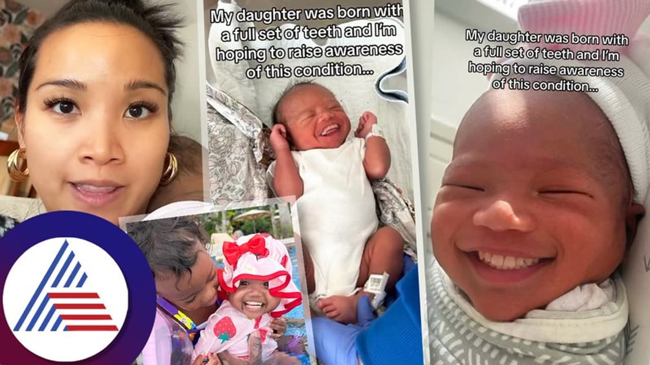 ಅಚ್ಚಕುಟ್ಟಾದ 32 ಹಲ್ಲಿನೊಂದಿಗೆ ಹುಟ್ಟಿದ ಹೆಣ್ಣು ಮಗು, ಈಗಿನ ಮಕ್ಕಳು ತುಂಬಾ ಫಾಸ್ಟ್! ಅಚ್ಚಕುಟ್ಟಾದ 32 ಹಲ್ಲಿನೊಂದಿಗೆ ಹುಟ್ಟಿದ ಹೆಣ್ಣು ಮಗು, ಈಗಿನ ಮಕ್ಕಳು ತುಂಬಾ ಫಾಸ್ಟ್!