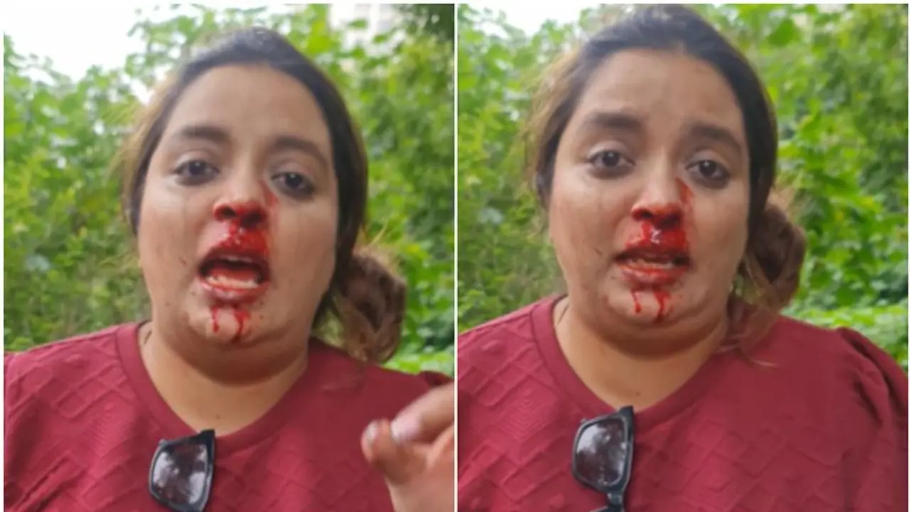 WATCH: Video of Pune woman punched in face in road rage incident goes viral
