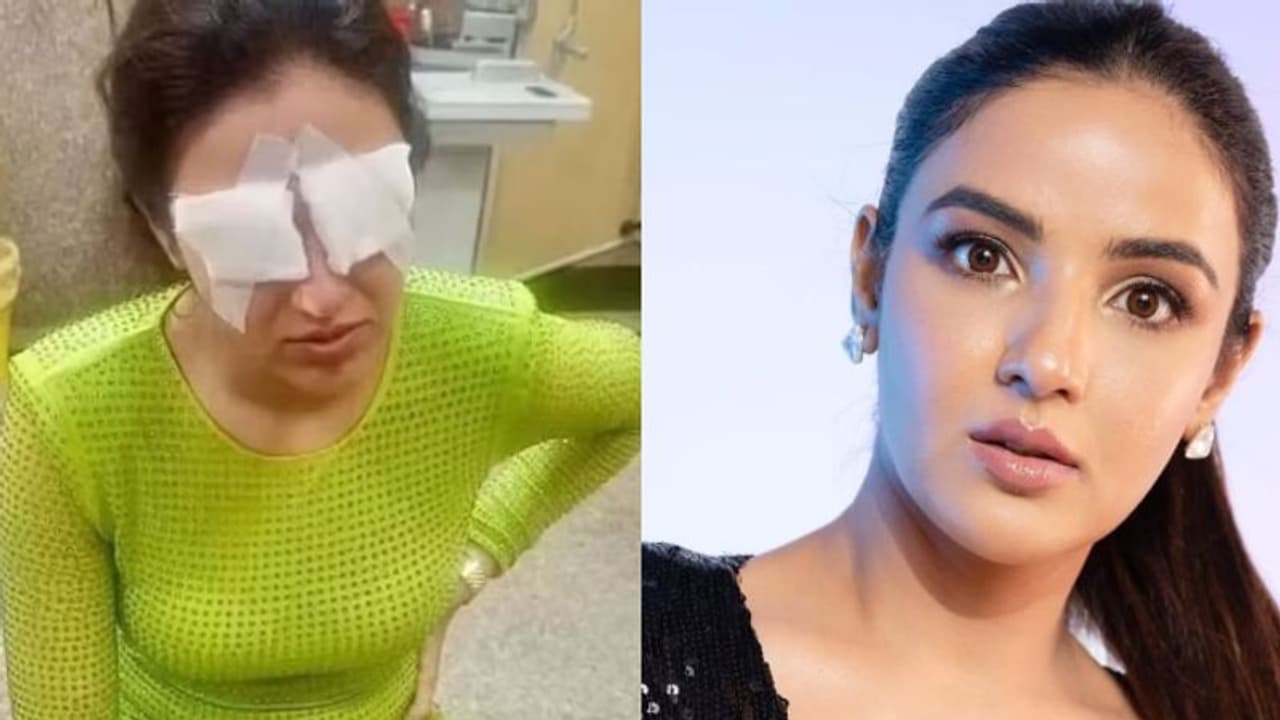 'ഒന്നും കാണാന് പറ്റുന്നില്ല', ലെൻസ് ധരിച്ചതിനെ തുടർന്ന് കോർണിയ തകരാറിലായി; നടി ജാസ്മിൻ ചികിത്സയിൽ 'ഒന്നും കാണാന് പറ്റുന്നില്ല', ലെൻസ് ധരിച്ചതിനെ തുടർന്ന് കോർണിയ തകരാറിലായി; നടി ജാസ്മിൻ ചികിത്സയിൽ