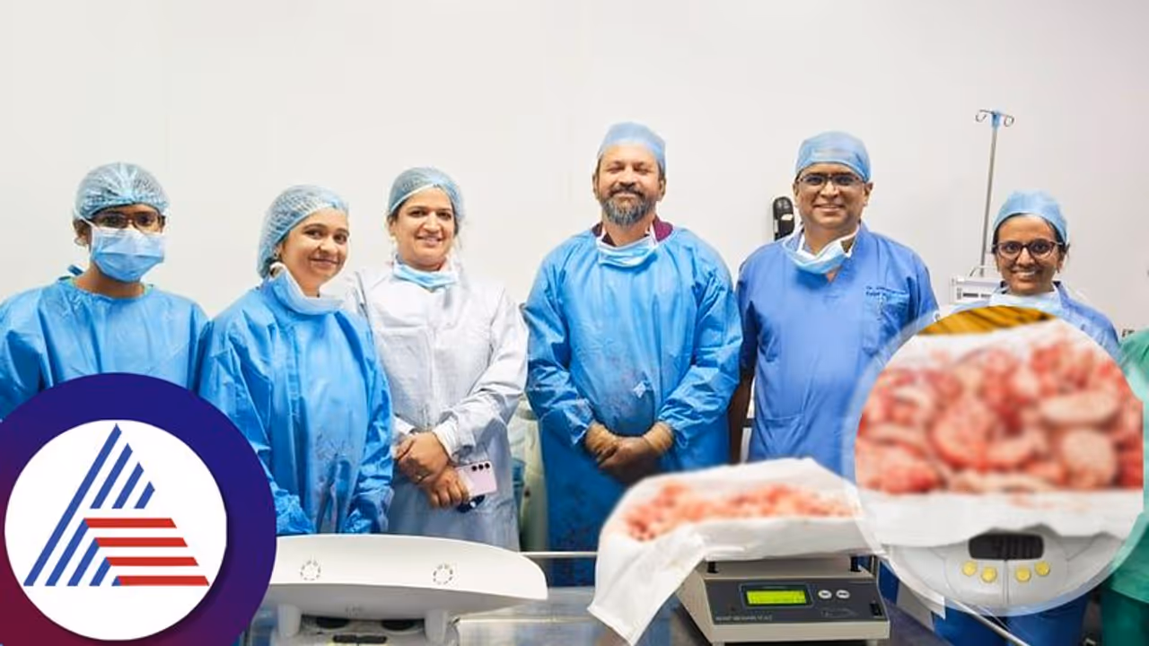 ದಕ್ಷಿಣ ಭಾರತದಲ್ಲೇ ಆಸ್ಟರ್ ಆರ್ವಿ ಆಸ್ಪತ್ರೆ ಮಹಾಸಾಧನೆ, ಲ್ಯಾಪ್ರೋಸ್ಕೋಪಿ ಮೂಲಕ 4 ಕೆಜಿ ತೂಕದ ಫೈಬ್ರಾಯ್ಡ್ ತೆಗೆದ ವೈದ್ಯರು! ದಕ್ಷಿಣ ಭಾರತದಲ್ಲೇ ಆಸ್ಟರ್ ಆರ್ವಿ ಆಸ್ಪತ್ರೆ ಮಹಾಸಾಧನೆ, ಲ್ಯಾಪ್ರೋಸ್ಕೋಪಿ ಮೂಲಕ 4 ಕೆಜಿ ತೂಕದ ಫೈಬ್ರಾಯ್ಡ್ ತೆಗೆದ ವೈದ್ಯರು!