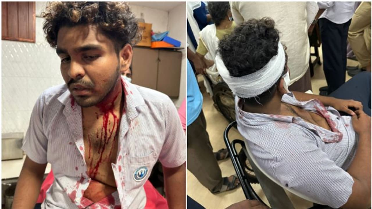 ബൈക്ക് തടഞ്ഞ് ചാവി കൊണ്ട് കുത്തിപ്പരിക്കേൽപ്പിച്ചു; വിദ്യാർഥിക്ക് സീനിയർ വിദ്യാർഥികളുടെ ക്രൂരമർദനമെന്ന് പരാതി ബൈക്ക് തടഞ്ഞ് ചാവി കൊണ്ട് കുത്തിപ്പരിക്കേൽപ്പിച്ചു; വിദ്യാർഥിക്ക് സീനിയർ വിദ്യാർഥികളുടെ ക്രൂരമർദനമെന്ന് പരാതി