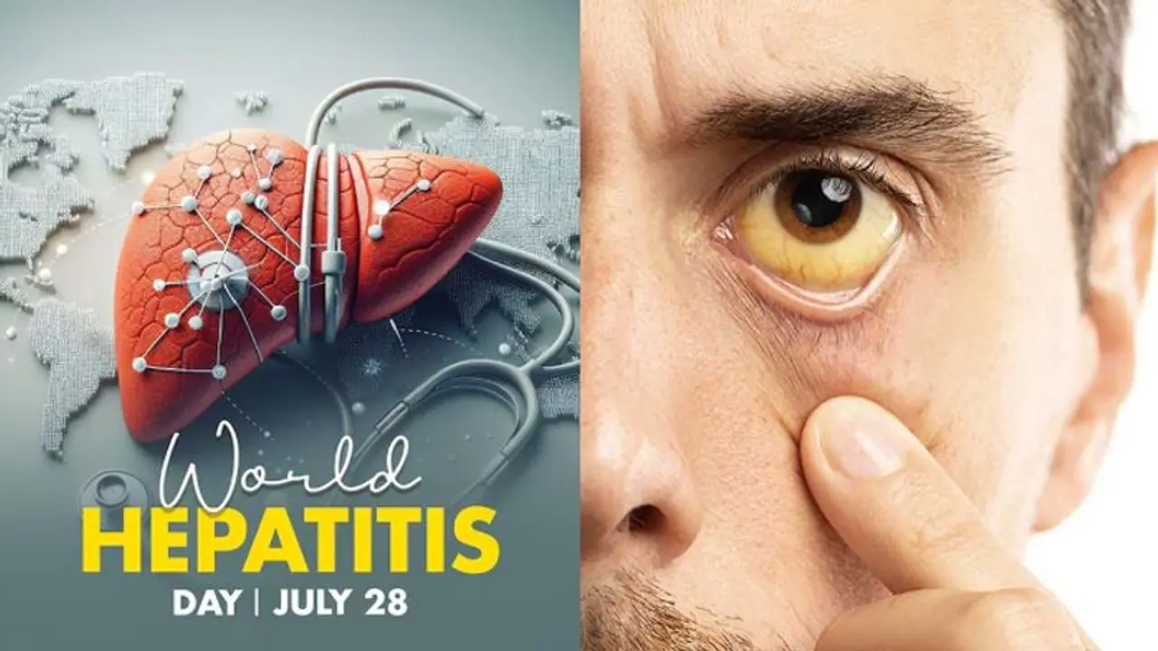 Hepatitis: What type of liver infection is this? Types, symptoms, causes and more Hepatitis: What type of liver infection is this? Types, symptoms, causes and more