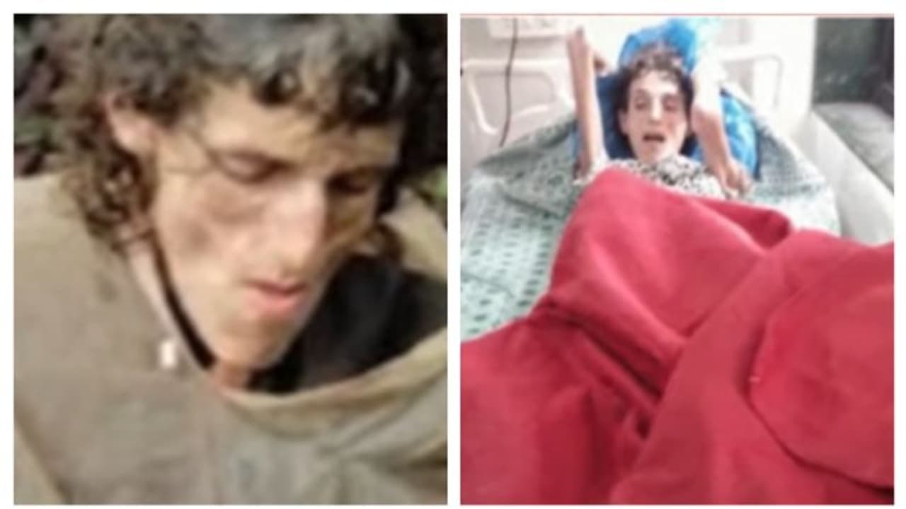 മരത്തിൽ ചങ്ങല കൊണ്ട് കെട്ടിയിട്ട നിലയിൽ വിദേശ വനിത; ആശുപത്രിയിലേക്ക് മാറ്റി; കണ്ടെത്തിയത് സിന്ധുദുര്ഗില് മരത്തിൽ ചങ്ങല കൊണ്ട് കെട്ടിയിട്ട നിലയിൽ വിദേശ വനിത; ആശുപത്രിയിലേക്ക് മാറ്റി; കണ്ടെത്തിയത് സിന്ധുദുര്ഗില്