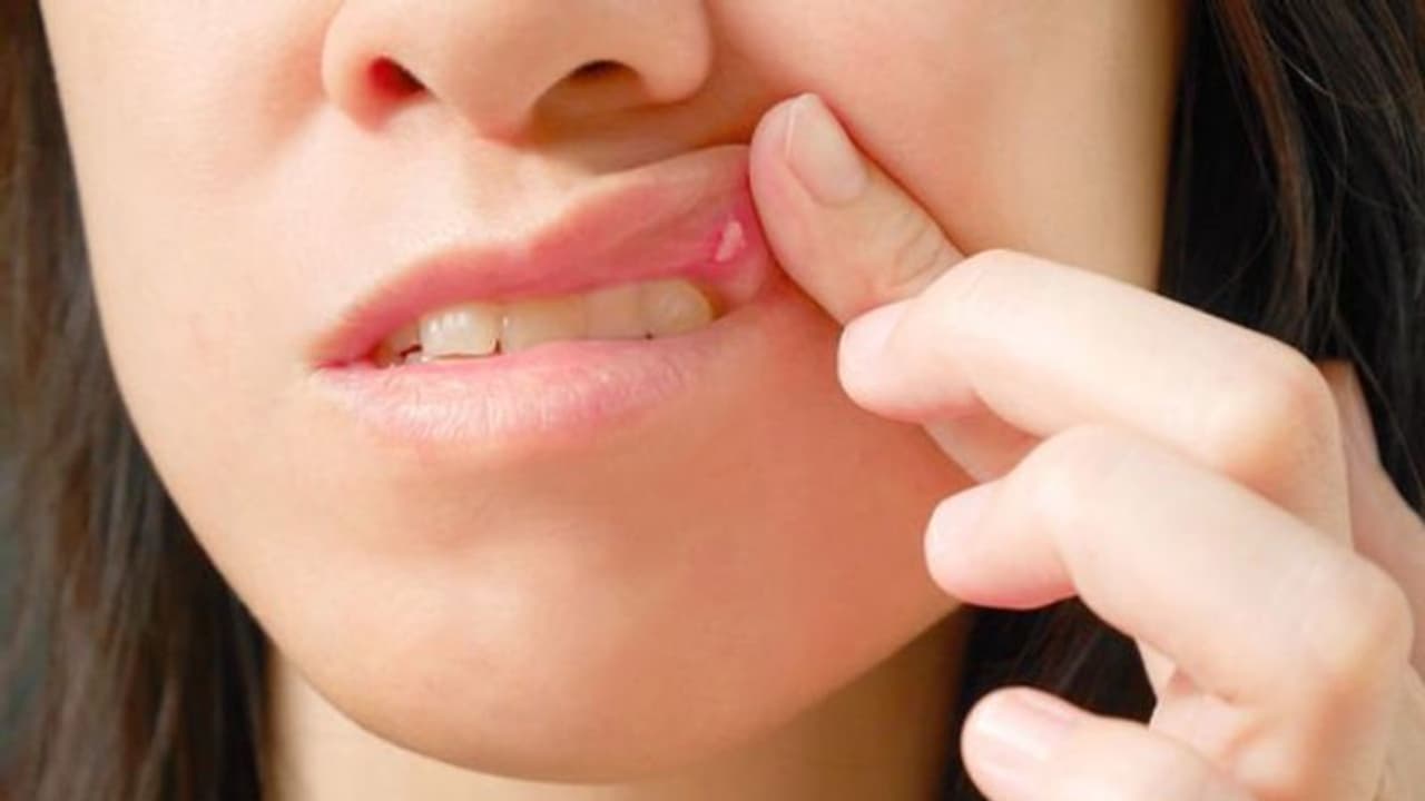 വിറ്റാമിന്‍ ബി12 ന്‍റെ കുറവിനെ പരിഹരിക്കാന്‍ ഡയറ്റില്‍ ഉള്‍പ്പെടുത്തേണ്ട പത്ത് ഭക്ഷണങ്ങള്‍