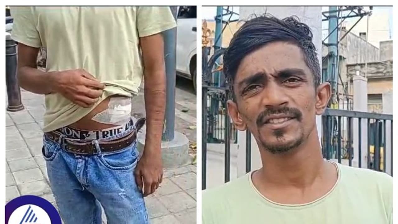 ಕದ್ದ ಬೈಕ್ ತೆಗೆದುಕೊಂಡು ಹೋಗುವಾಗ ಆಯತಪ್ಪಿ ಬಿದ್ದರೂ ನೆರವಿಗೆ ಬಂದಿಲ್ಲವೆಂದು ಸ್ನೇಹಿತನಿಗೆ ಚಾಕು ಇರಿತ! ಕದ್ದ ಬೈಕ್ ತೆಗೆದುಕೊಂಡು ಹೋಗುವಾಗ ಆಯತಪ್ಪಿ ಬಿದ್ದರೂ ನೆರವಿಗೆ ಬಂದಿಲ್ಲವೆಂದು ಸ್ನೇಹಿತನಿಗೆ ಚಾಕು ಇರಿತ!