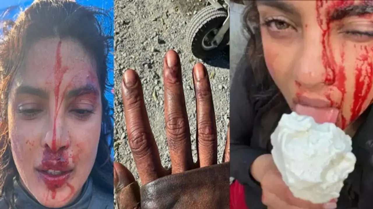 Real or fake? The truth behind Priyanka Chopra's disturbing pictures, videos on Instagram