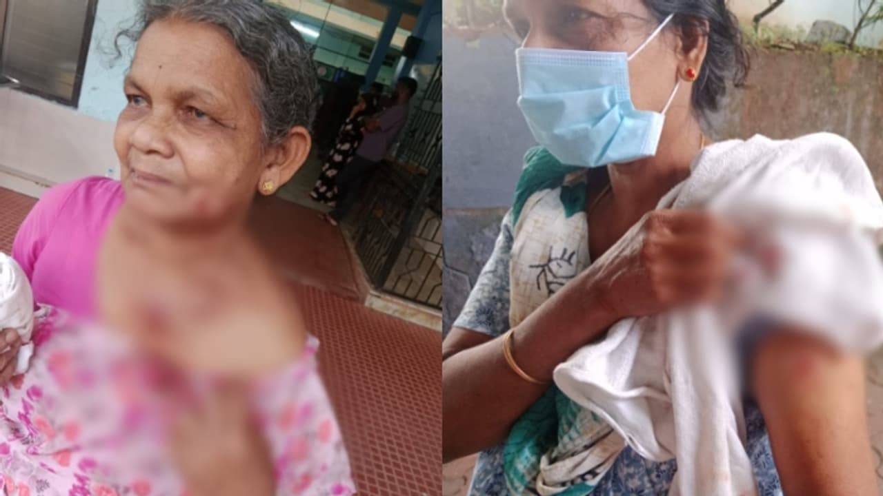  വീട്ടുമുറ്റത്തു നിന്നവരാണ്, ഓടിനടന്ന് കടിച്ചത് 18 സ്ത്രീകൾ ഉൾപ്പെടെ 23 പേരെ, കോഴിക്കോട് തെരുവുനായ ആക്രമണം