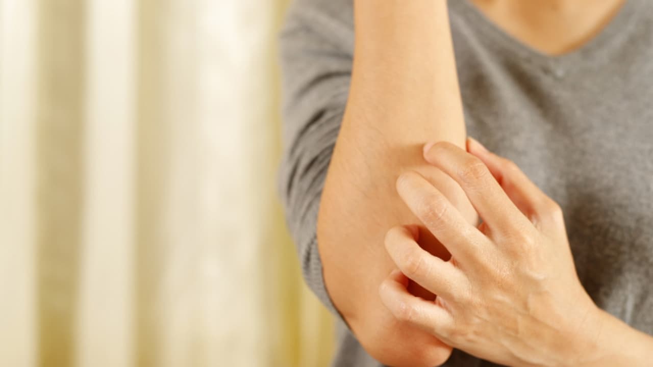 Health Tips: സോറിയാസിസ് രോഗത്തെ എങ്ങനെ തിരിച്ചറിയാം? ലക്ഷണങ്ങള് ഇങ്ങനെ Health Tips: സോറിയാസിസ് രോഗത്തെ എങ്ങനെ തിരിച്ചറിയാം? ലക്ഷണങ്ങള് ഇങ്ങനെ