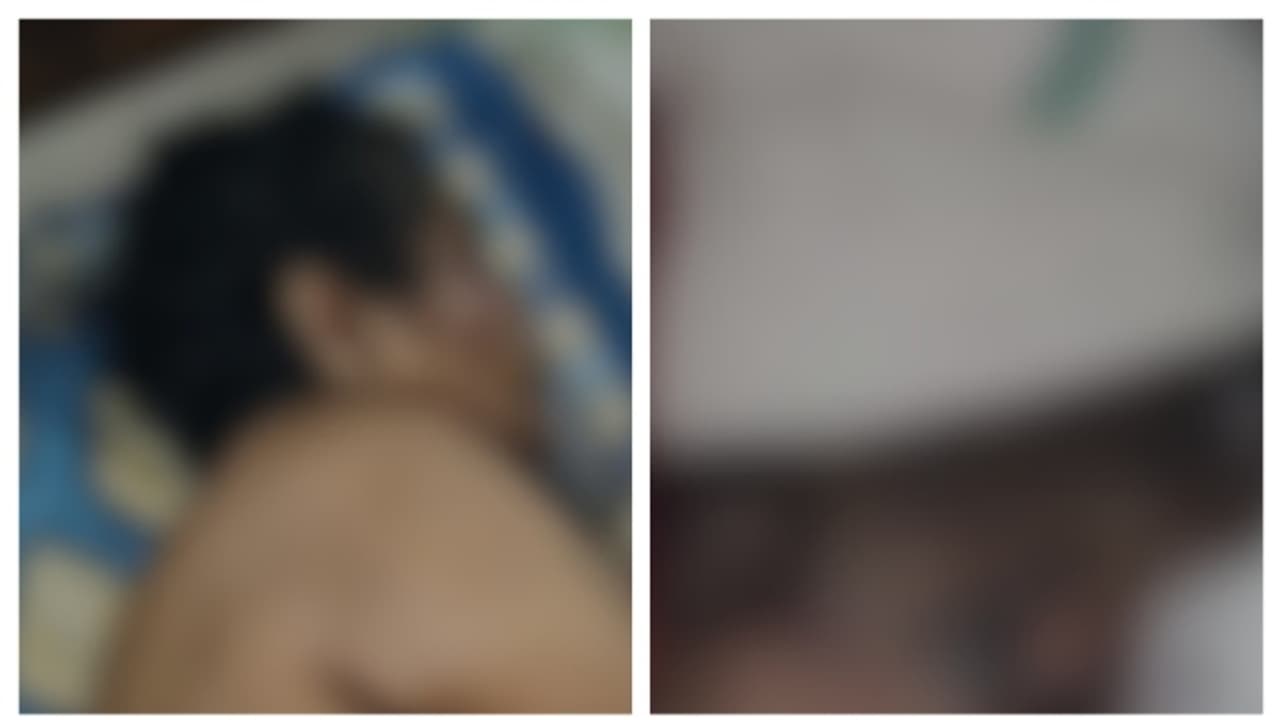 നിലമ്പൂർ ജില്ല ആശുപത്രിയിൽ വൃദ്ധയോട് ക്രൂരത; കാലിൽ പുഴുവരിക്കുന്ന മുറിവ് ഭേദമാകാതെ വീട്ടിലേക്കയച്ചു നിലമ്പൂർ ജില്ല ആശുപത്രിയിൽ വൃദ്ധയോട് ക്രൂരത; കാലിൽ പുഴുവരിക്കുന്ന മുറിവ് ഭേദമാകാതെ വീട്ടിലേക്കയച്ചു