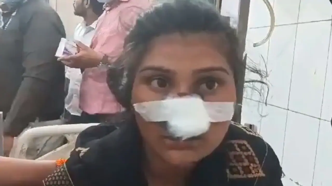 ರಾಖಿ ಕಟ್ಟಲು ತವರಿಗೆ ಹೊರಟ ಹೆಂಡತಿಯ ಮೂಗು ಕತ್ತರಿಸಿದ ಪಾಪಿ ಗಂಡ! ರಾಖಿ ಕಟ್ಟಲು ತವರಿಗೆ ಹೊರಟ ಹೆಂಡತಿಯ ಮೂಗು ಕತ್ತರಿಸಿದ ಪಾಪಿ ಗಂಡ!