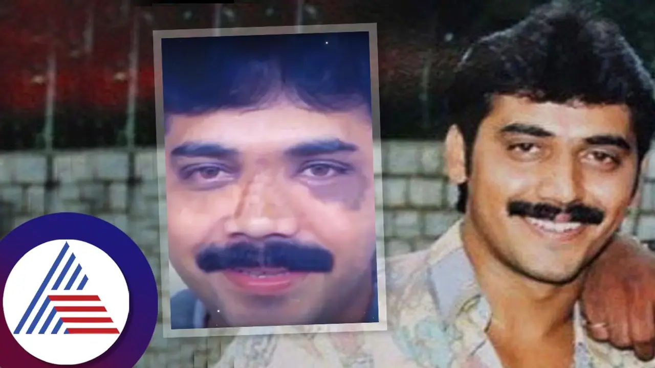 ನಟ ಶಶಿಕುಮಾರ್ ಮುಖ ಗುರುತೇ ಸಿಗದಷ್ಟು ಬದಲಾವಣೆ; ಆ ಆಕ್ಸಿಡೆಂಟ್ ನಂತರ ಏನಾಯ್ತು? 