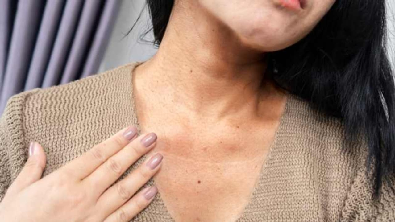 കഴുത്തിന് ചുറ്റുമുള്ള കറുത്ത പാടുകൾ മാറ്റാന്‍ ഇതാ ചില പൊടിക്കൈകള്‍