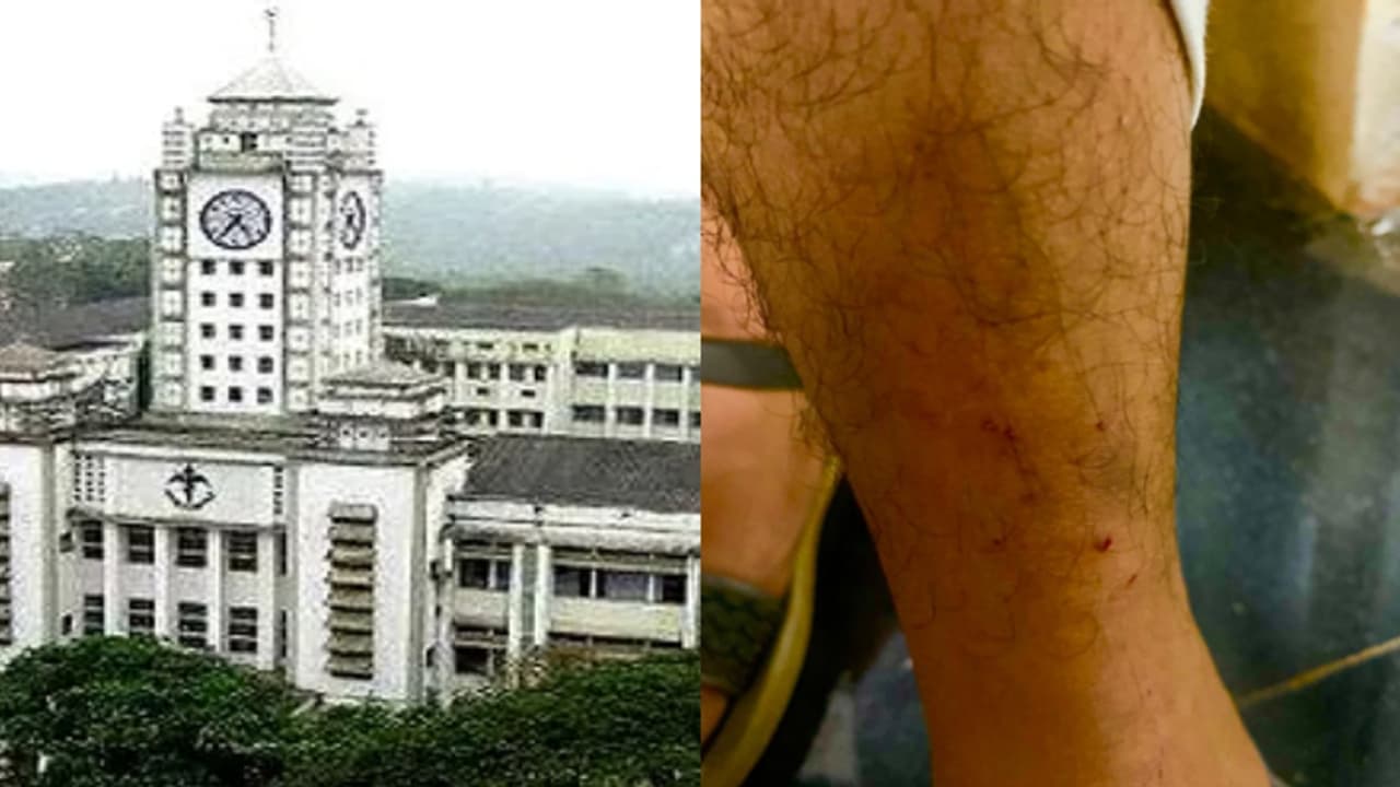 മെഡിക്കല് കോളേജില് ചികിത്സയിലുള്ള കുഞ്ഞിന്റെ അമ്മക്ക് പൂച്ചയുടെ കടിയേറ്റു, ചികിത്സ വൈകിയെന്ന് ആരോപണം മെഡിക്കല് കോളേജില് ചികിത്സയിലുള്ള കുഞ്ഞിന്റെ അമ്മക്ക് പൂച്ചയുടെ കടിയേറ്റു, ചികിത്സ വൈകിയെന്ന് ആരോപണം