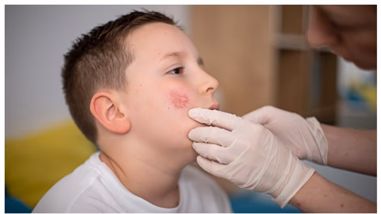 ഹോംവര്‍ക്ക് ചെയ്തില്ല, അധ്യാപകന്‍ കുട്ടിയുടെ മുഖത്തടിച്ചു; കുട്ടിക്ക് പാണ്ടുരോഗം ബാധിച്ചെന്ന് അമ്മ