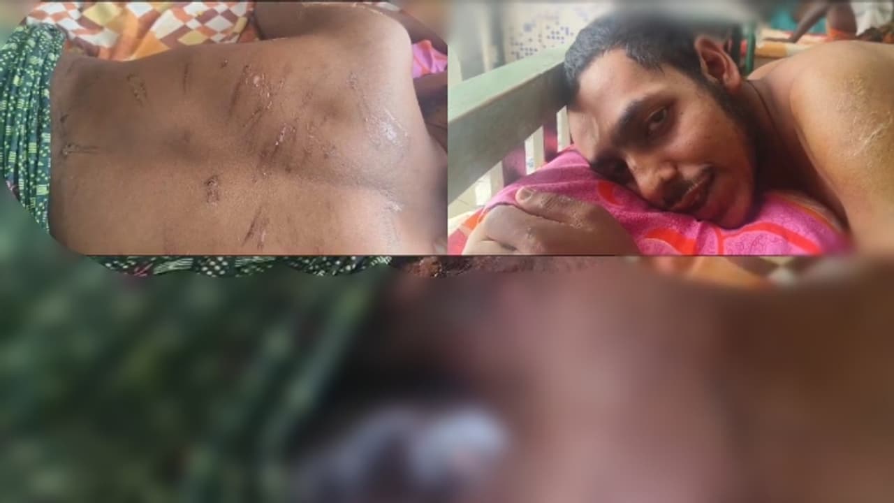 'മതപഠനം നന്നായി നടത്തുന്നില്ലെന്ന് പരാതി, 23കാരന് ക്രൂരമര്ദ്ദനം' ഉസ്താദിനെതിരെ പരാതി, ഉടൻ നടപടിയെന്ന് പൊലീസ് 'മതപഠനം നന്നായി നടത്തുന്നില്ലെന്ന് പരാതി, 23കാരന് ക്രൂരമര്ദ്ദനം' ഉസ്താദിനെതിരെ പരാതി, ഉടൻ നടപടിയെന്ന് പൊലീസ്