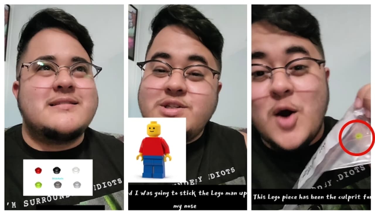 26 വർഷം മുമ്പ് മൂക്കില്‍ പോയ കളിപ്പാട്ട കഷ്ണം നിസാരമായി പുറത്തെടുത്ത അനുഭവം പങ്കുവച്ച് യുവാവ്; വീഡിയ വൈറൽ