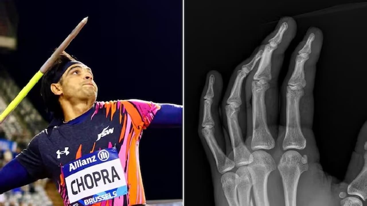 ಎಡಗೈ ಮುರಿದಿದ್ದರೂ ಡೈಮಂಡ್‌ ಲೀಗ್‌ ಫೈನಲ್ಸ್‌ನಲ್ಲಿ ನೀರಜ್‌ ಚೋಪ್ರಾ ರನ್ನರ್‌ ಅಪ್‌